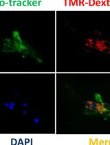 Visualization of Macropinocytosis in Prostate Fibroblasts