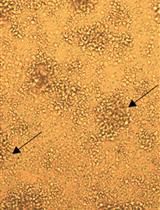 Detection of Antigen-specific T cells in Spleens of Vaccinated Mice Applying 3[H]-Thymidine Incorporation Assay and Luminex Multiple Cytokine Analysis Technology