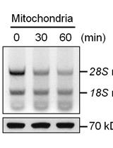Organelle-associated rRNA Degradation
