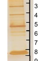 利用交联、免疫沉淀和蛋白质组学分析法鉴定培养细胞中互作的蛋白质