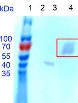 A Detailed Protocol for Large-scale Recombinant Expression and Validation of Human FGFR2 with Its Transmembrane and Extracellular Domains in Escherichia coli