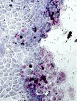 Plaque Assay to Determine Invasion and Intercellular Dissemination of <em>Shigella flexneri</em> in TC7 Human Intestinal Epithelial Cells