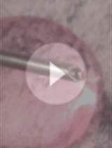 Optogenetic Inactivation of Transcription Factors in the Early Embryo of Drosophila