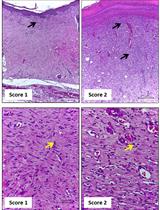 Morphological Evaluation of Wound Healing Events in the Excisional Wound Healing Model in Rats