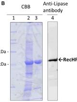 Preparation and Purification of Active Recombinant Human Pancreatic Lipase in Escherichia coli