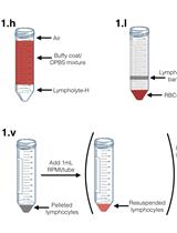 原代人单核细胞的体外HIV-1侵染