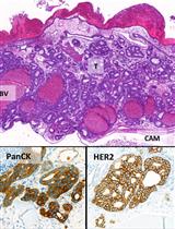 The Chick Chorioallantoic Membrane (CAM) Assay as a Three-dimensional Model to Study Autophagy in Cancer Cells