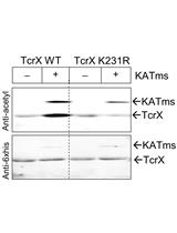 <em>In vitro</em> and <em>in vivo</em> Assessment of Protein Acetylation Status in <em>Mycobacteria</em>
