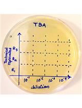 Gentamicin Protection Assay to Determine the Number of Intracellular Bacteria during Infection of Human TC7 Intestinal Epithelial Cells by Shigella flexneri