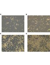 Isolation and Long-term Cultivation of Mouse Alveolar Macrophages