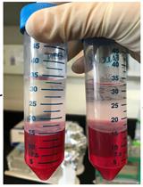 Total RNA Isolation from Separately Established Monolayer and Hydrogel Cultures of Human Glioblastoma Cell Line