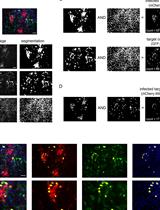 Image-based Quantification of Direct Cell-to-cell Transmission of Bovine Viral Diarrhea Virus