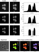 QUEEN-based Spatiotemporal ATP Imaging in Budding and Fission Yeast