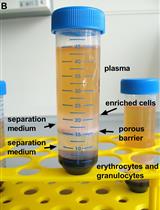 Ex vivo Analysis of DNA Repair Capacity of Human Peripheral Blood Mononuclear  Cells by a Modified Host Cell Reactivation Assay