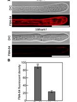 Endocytosis Detection in Magnaporthe oryzae