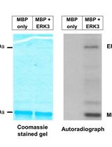 A Radioactive in vitro ERK3 Kinase Assay