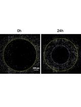 Fibroblast Gap-closure Assay-Microscopy-based in vitro Assay Measuring  the Migration of Murine Fibroblasts
