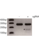 Construction of Viral Vectors for Cell Type-specific CRISPR Gene Editing in the Adult Mouse Brain