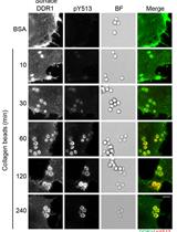 Cell-based Assay for Recruitment of DDR1 to Collagen-coated Beads