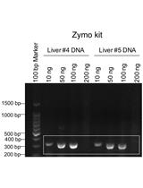 Genotyping of the OATP1B1 c. 521 T>C Polymorphism from the Formalin-Fixed Paraffin-Embedded (FFPE) Tissue Specimens: An Optimized Protocol
