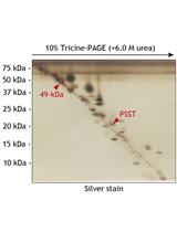Photoaffinity Labeling of Respiratory Complex I in Bovine Heart Submitochondrial  Particles by Photoreactive [<sup>125</sup>I] amilorides