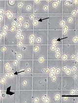 A High-throughput and Pathophysiologically Relevant Astrocyte-motor Neuron Co-culture Assay for Amyotrophic Lateral Sclerosis Therapeutic Discovery