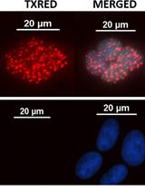 SIRF: A Single-cell Assay for <em>in situ</em> Protein Interaction with Nascent DNA Replication Forks