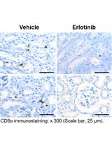 Immunohistochemical Staining of CD8α in Diabetic Mouse Kidney