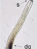 In situ Hybridization of Plant-parasitic Nematode Globodera pallida Juveniles to Detect Gene Expression