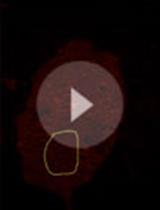 Supported Cell Membrane Sheets to Monitor Protein Assembly