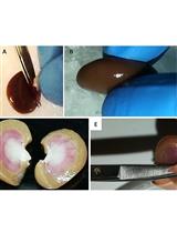 Isolation of Pure Mitochondria from Rat Kidneys and Western Blot of Mitochondrial Respiratory Chain Complexes