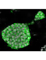 3D Organoid Formation from the Murine Salivary Gland Cell Line SIMS