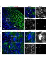 Immunofluorescence-based Determination of Centrosome Number in Tissue Samples