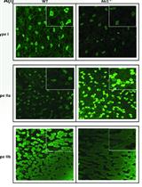 Immunohistochemical Identification of Muscle Fiber Types in Mice Tibialis Anterior Sections