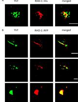 Isolation and Imaging of His- and RFP-tagged Amyloid-like Proteins from Caenorhabditis elegans by TEM and SIM