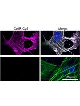Implementing VIPER for Imaging Cellular Proteins by Fluorescence Microscopy
