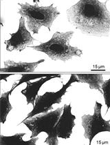 Imaging VIPER-labeled Cellular Proteins by Correlative Light and Electron Microscopy