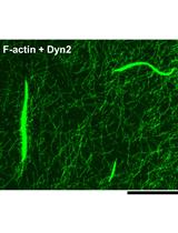 F-actin Bundle Sedimentation Assay
