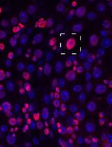 Determination of Chromatin Accessibility in Drosophila Midgut Enterocytes by in situ 5mC Labeling
