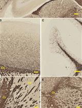 Gallyas Silver Impregnation of Myelinated Nerve Fibers