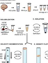 SarkoSpin: A Technique for Biochemical Isolation and Characterization  of Pathological TDP-43 Aggregates