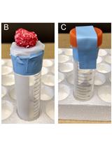 Isolation and Quantification of Metabolite Levels in Murine Tumor Interstitial Fluid by LC/MS 