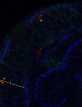 Measurement of Mitotic Spindle Angle and Mitotic Cell Distance in Fixed Tissue of <em>Drosophila</em> Larval Brains