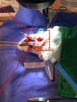 Intra-arterial Drug Delivery to the Ischemic Brain in Rat Middle Cerebral Artery Occlusion Model