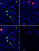 Localizing Genome Segments and Protein Products of a Multipartite Virus in Host Plant Cells