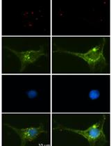 Proximity Ligation Assay for the Investigation of the Intramolecular Interaction of ELMO1