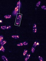 Quantification of Mitochondrial Dynamics in Fission Yeast