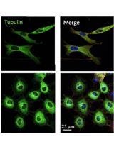 Mapping the Mechanome–A Protocol for Simultaneous Live Imaging and Quantitative  Analysis of Cell Mechanoadaptation and Ingression