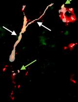 Semi-automated Model to Accurately Counting Sympathetic Nervous Fibers