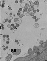 Propagation and Purification of Chlamydia trachomatis Serovar L2 Transformants and Mutants
